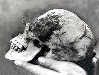 Photo of &quot;Bella's&quot; skull found in the Wych Elm.  Image credit: Atlas Obscura (Public Domain)